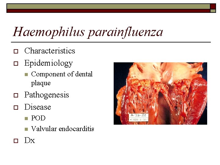 Haemophilus parainfluenza o o Characteristics Epidemiology n o o Pathogenesis Disease n n o