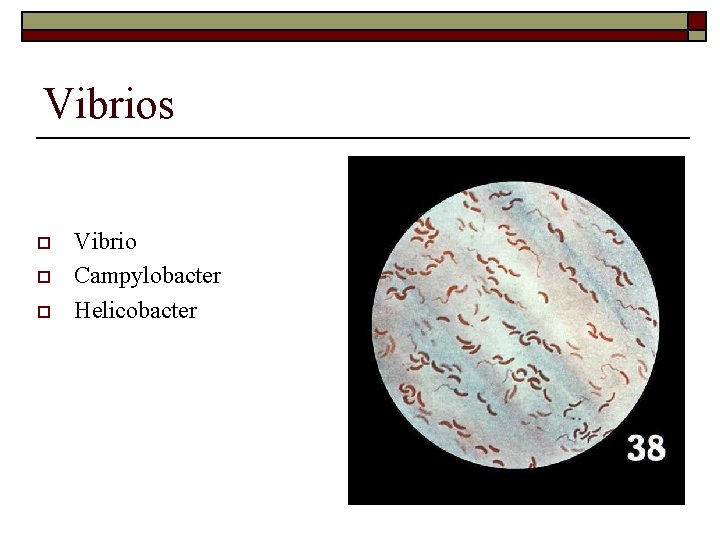 Vibrios o o o Vibrio Campylobacter Helicobacter 