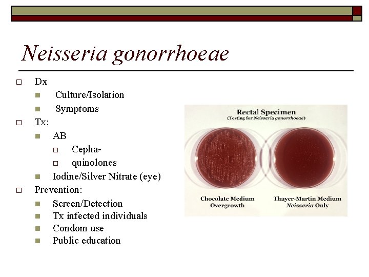 Neisseria gonorrhoeae o Dx n n o Culture/Isolation Symptoms Tx: n AB Cephao quinolones