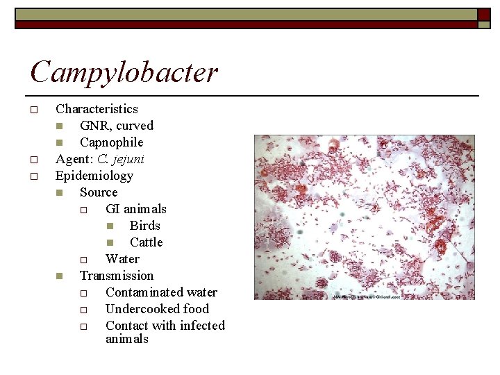 Campylobacter o o o Characteristics n GNR, curved n Capnophile Agent: C. jejuni Epidemiology