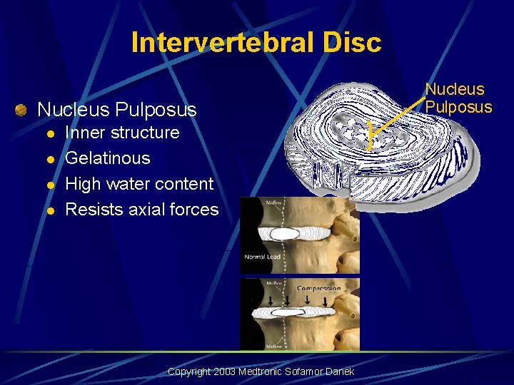 Intervertebral Disc Nucleus Pulposus l l Inner structure Gelatinous High water content Resists axial Intervertebral Disc Nucleus Pulposus l l Inner structure Gelatinous High water content Resists axial