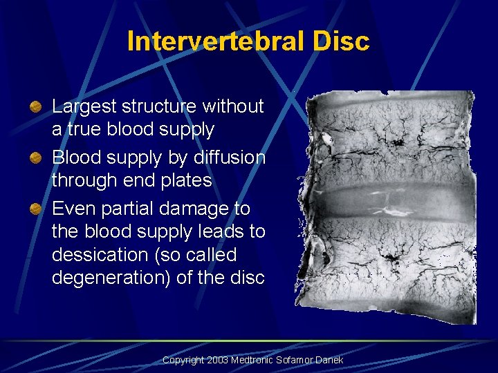 Intervertebral Disc Largest structure without a true blood supply Blood supply by diffusion through Intervertebral Disc Largest structure without a true blood supply Blood supply by diffusion through