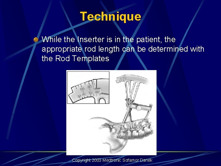 Technique While the Inserter is in the patient, the appropriate rod length can be Technique While the Inserter is in the patient, the appropriate rod length can be