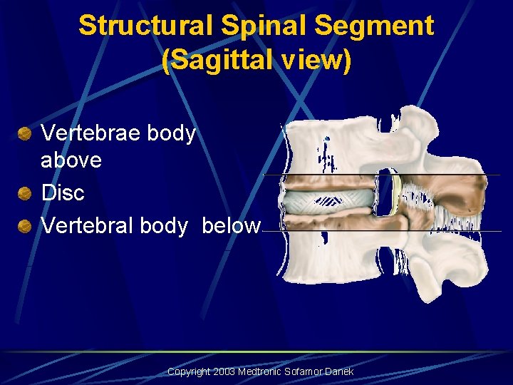 Structural Spinal Segment (Sagittal view) Vertebrae body above Disc Vertebral body below Copyright 2003 Structural Spinal Segment (Sagittal view) Vertebrae body above Disc Vertebral body below Copyright 2003