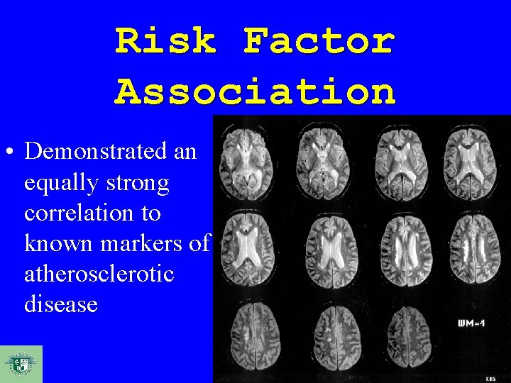 Risk Factor Association • Demonstrated an equally strong correlation to known markers of atherosclerotic