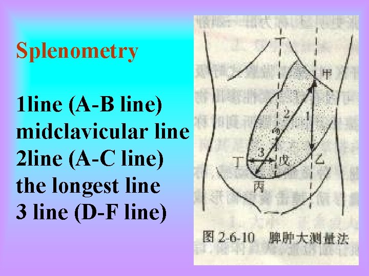 Splenometry 1 line (A-B line) midclavicular line 2 line (A-C line) the longest line