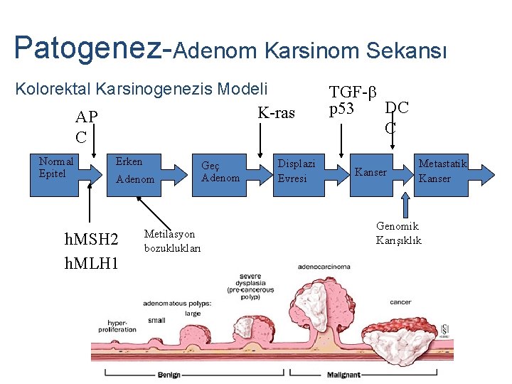 Patogenez-Adenom Karsinom Sekansı Kolorektal Karsinogenezis Modeli K-ras AP C Normal Epitel Erken Adenom h.