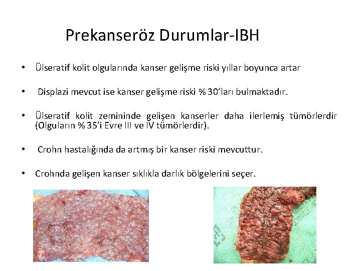 Prekanseröz Durumlar-IBH • Ülseratif kolit olgularında kanser gelişme riski yıllar boyunca artar • Displazi