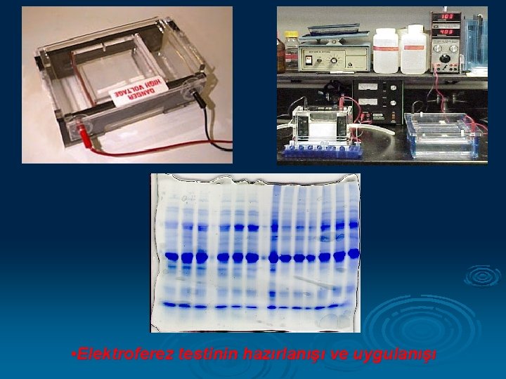  • Elektroferez testinin hazırlanışı ve uygulanışı 