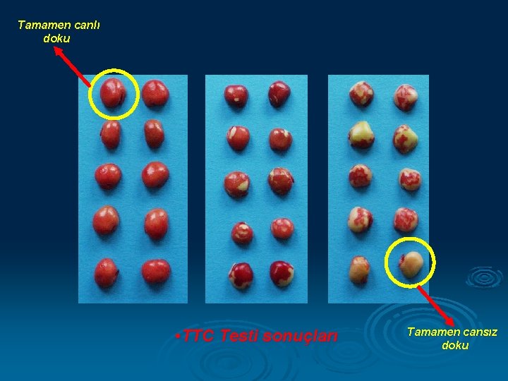 Tamamen canlı doku • TTC Testi sonuçları Tamamen cansız doku 