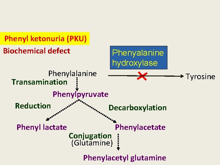 Phenyl ketonuria (PKU) Biochemical defect Phenyalanine hydroxylase Phenylalanine Transamination Phenylpyruvate Reduction Decarboxylation Phenyl lactate