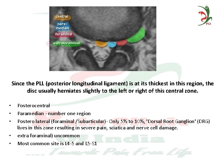 Since the PLL (posterior longitudinal ligament) is at its thickest in this region, the