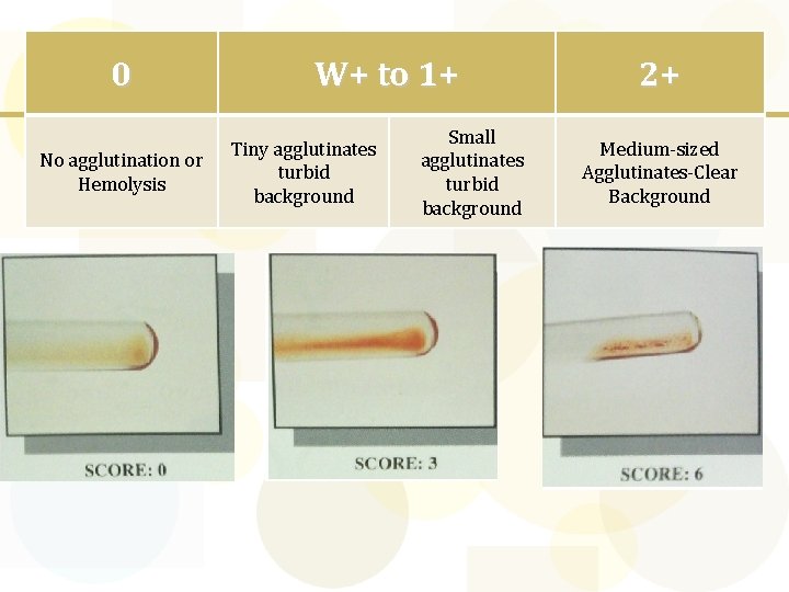 0 No agglutination or Hemolysis W+ to 1+ Tiny agglutinates turbid background Small agglutinates