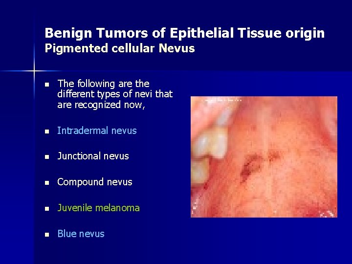 Benign Tumors of Epithelial Tissue origin Pigmented cellular Nevus n The following are the