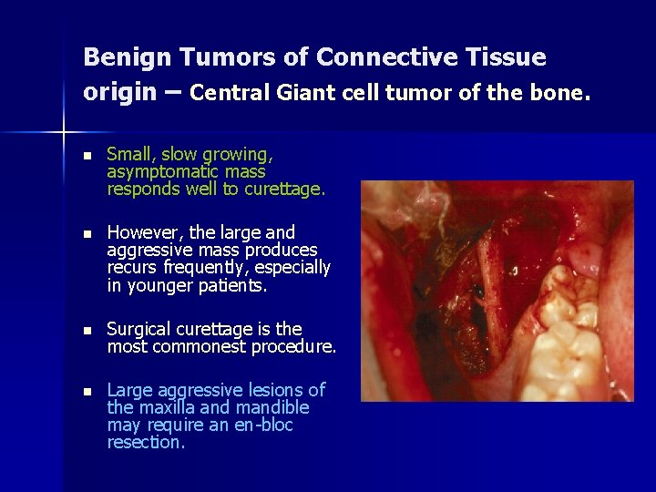 Benign Tumors of Connective Tissue origin – Central Giant cell tumor of the bone.