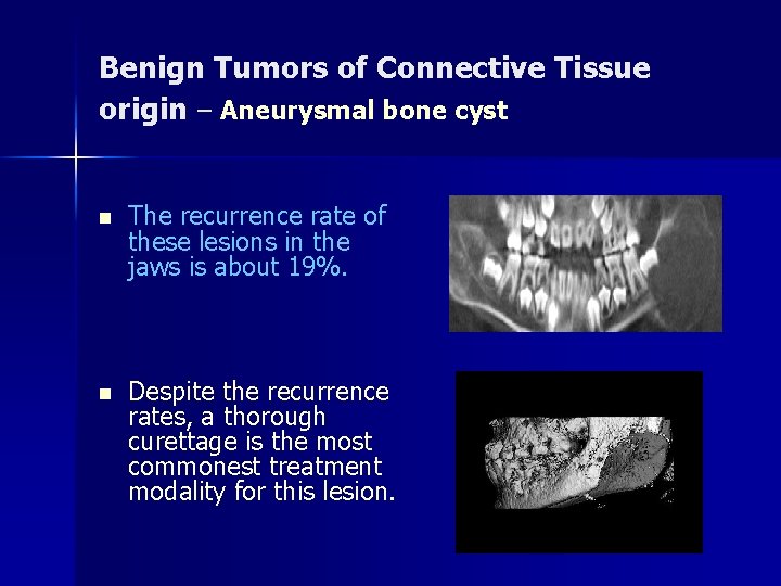 Benign Tumors of Connective Tissue origin – Aneurysmal bone cyst n The recurrence rate