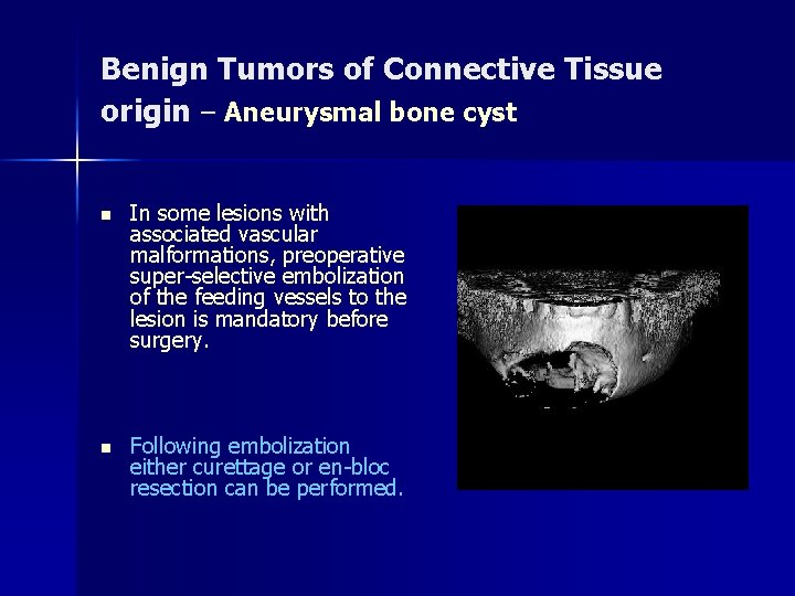 Benign Tumors of Connective Tissue origin – Aneurysmal bone cyst n In some lesions