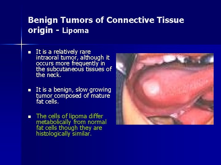 Benign Tumors of Connective Tissue origin - Lipoma n It is a relatively rare
