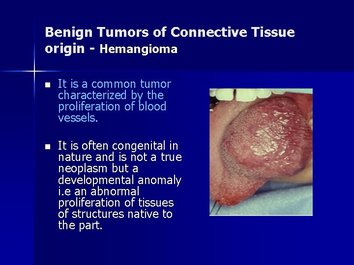 Benign Tumors of Connective Tissue origin - Hemangioma n It is a common tumor