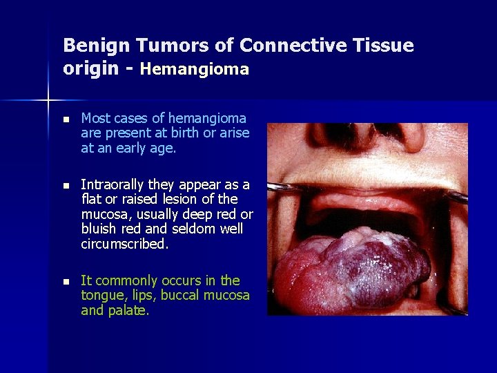 Benign Tumors of Connective Tissue origin - Hemangioma n Most cases of hemangioma are