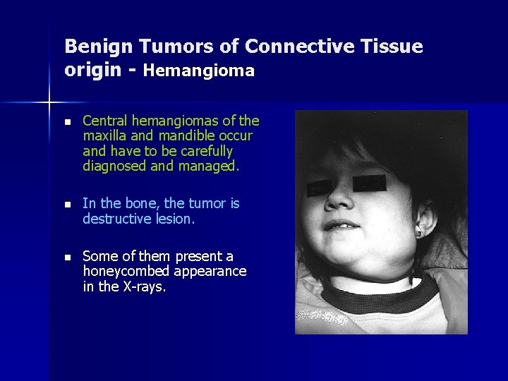 Benign Tumors of Connective Tissue origin - Hemangioma n Central hemangiomas of the maxilla