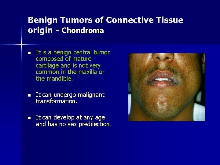 Benign Tumors of Connective Tissue origin - Chondroma n It is a benign central