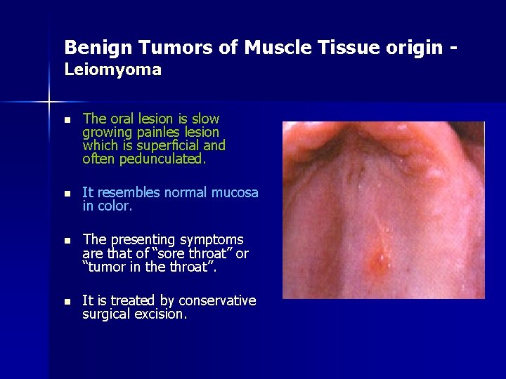 Benign Tumors of Muscle Tissue origin Leiomyoma n The oral lesion is slow growing