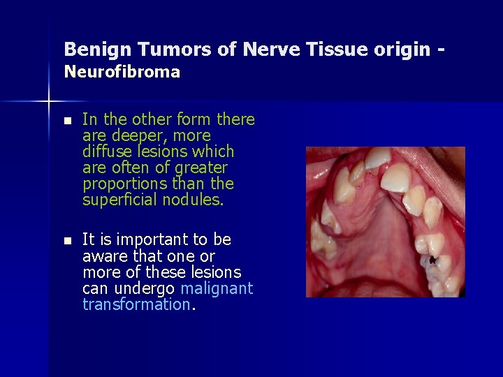 Benign Tumors of Nerve Tissue origin Neurofibroma n In the other form there are