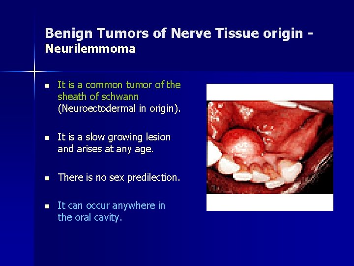 Benign Tumors of Nerve Tissue origin Neurilemmoma n It is a common tumor of