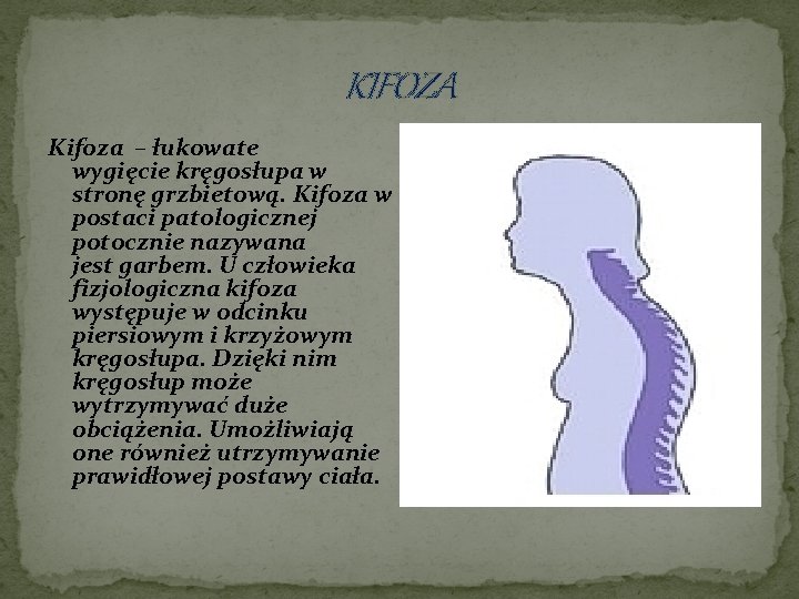 KIFOZA Kifoza – łukowate wygięcie kręgosłupa w stronę grzbietową. Kifoza w postaci patologicznej potocznie