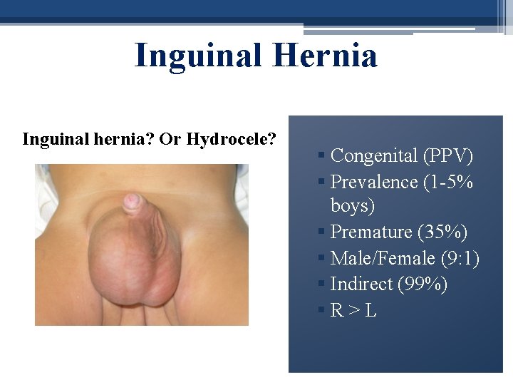Inguinal Hernia Inguinal hernia? Or Hydrocele? § Congenital (PPV) § Prevalence (1 -5% boys)