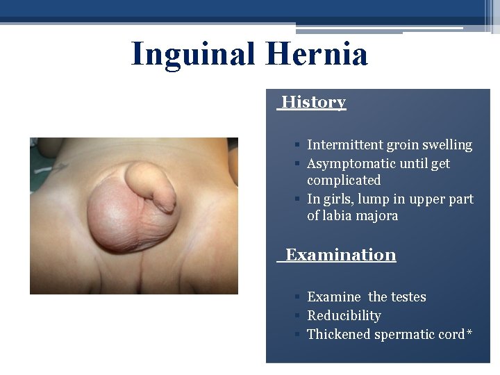 Inguinal Hernia History § Intermittent groin swelling § Asymptomatic until get complicated § In