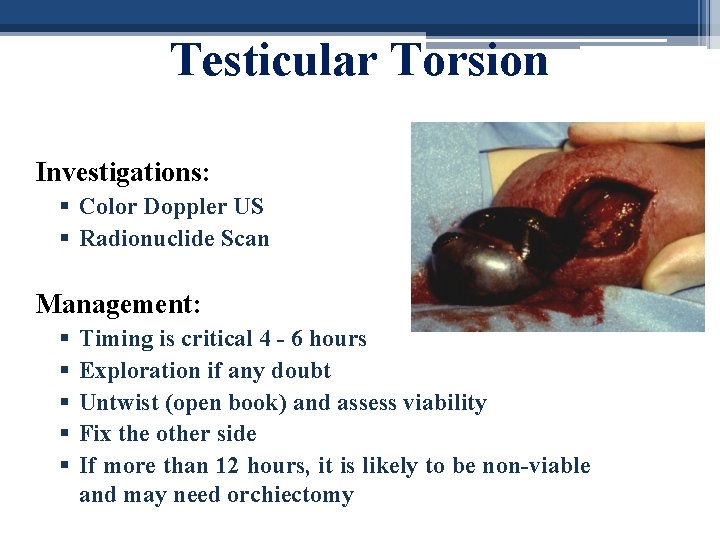 Testicular Torsion Investigations: § Color Doppler US § Radionuclide Scan Management: § § §