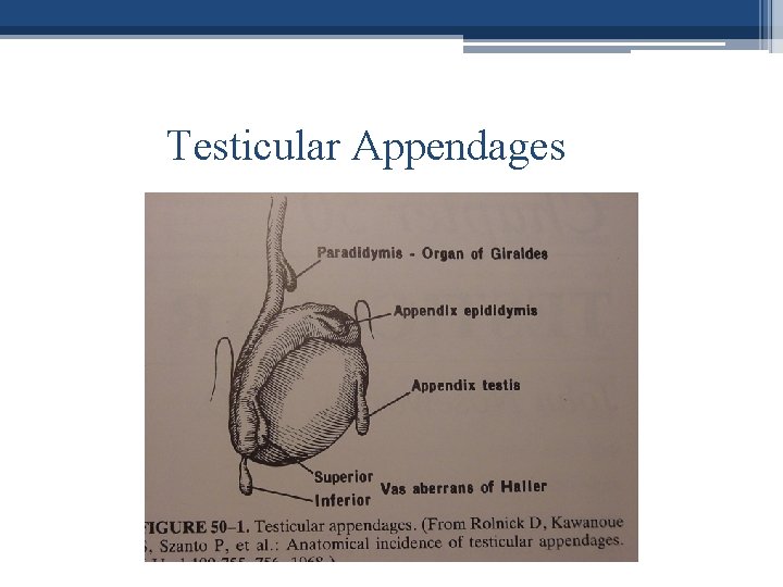 Testicular Appendages 