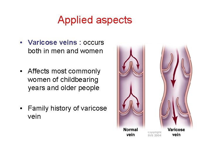 Applied aspects • Varicose veins : occurs both in men and women • Affects