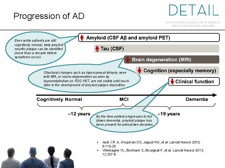 Progression of AD Even while patients are still cognitively normal, beta amyloid neuritic plaque