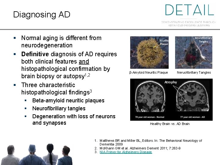 Diagnosing AD § Normal aging is different from neurodegeneration § Definitive diagnosis of AD