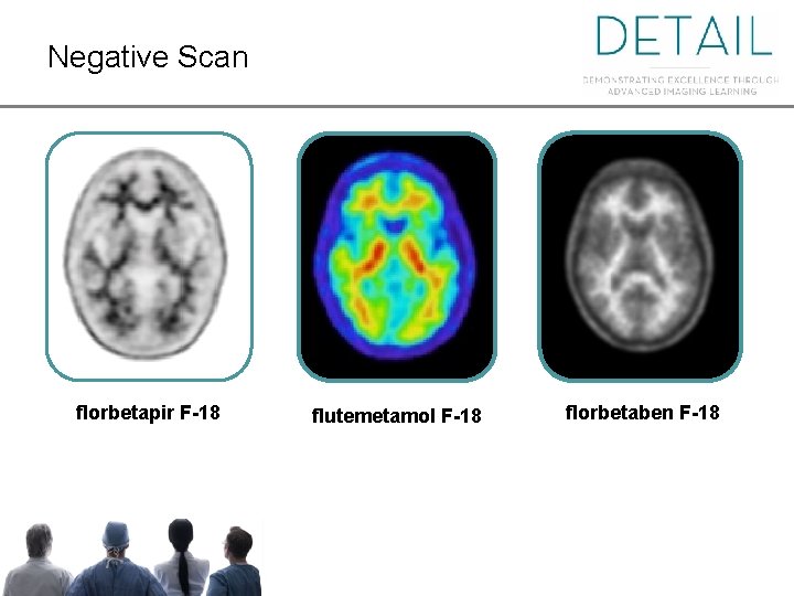 Negative Scan florbetapir F-18 flutemetamol F-18 florbetaben F-18 