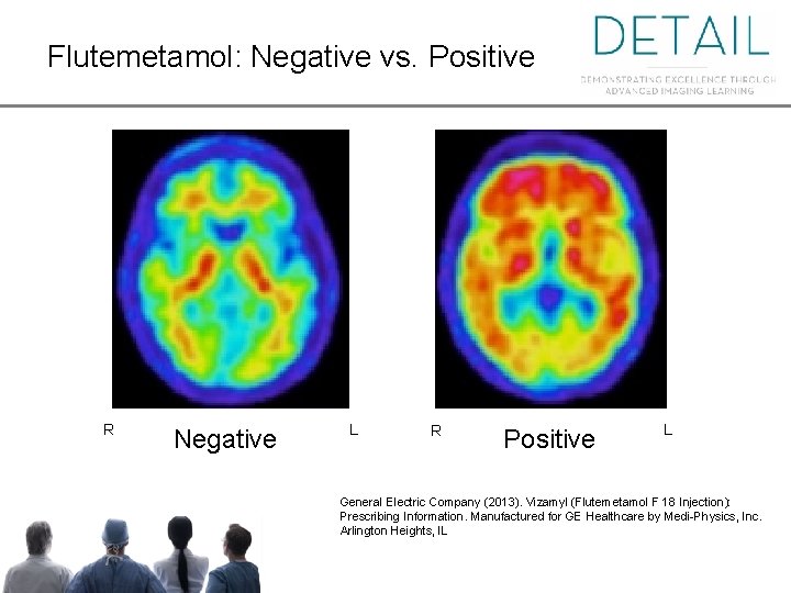 Flutemetamol: Negative vs. Positive Flutemetamol: Negative vs. . Positive R Negative L R Positive
