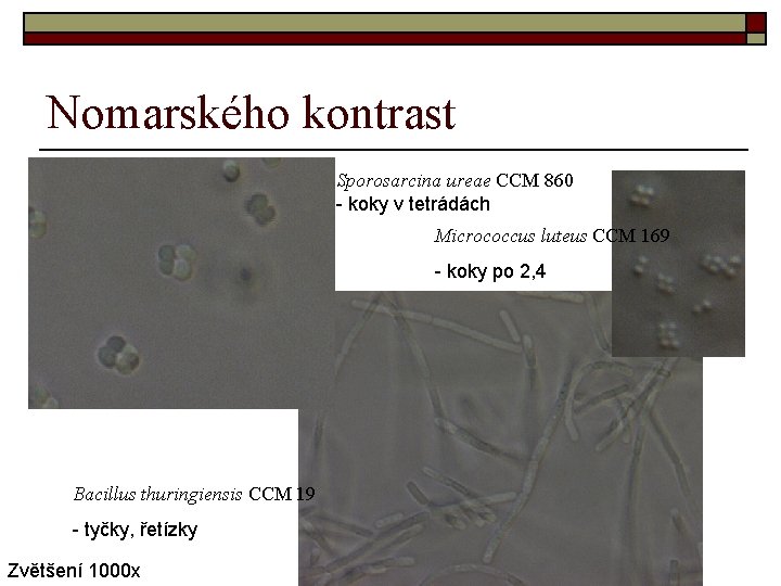 Nomarského kontrast Sporosarcina ureae CCM 860 - koky v tetrádách Micrococcus luteus CCM 169