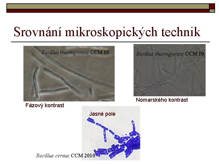 Srovnání mikroskopických technik Bacillus thuringiensis CCM 19 Nomarského kontrast Fázový kontrast Jasné pole Bacillus