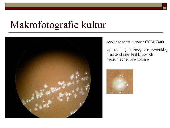 Makrofotografie kultur Streptococcus mutans CCM 7409 - pravidelný, kruhový tvar, vypouklý, hladké okraje, lesklý