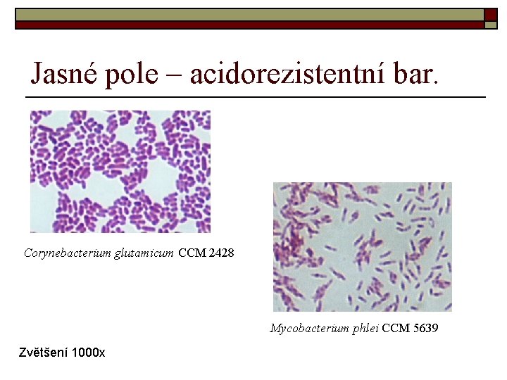 Jasné pole – acidorezistentní bar. Corynebacterium glutamicum CCM 2428 Mycobacterium phlei CCM 5639 Zvětšení