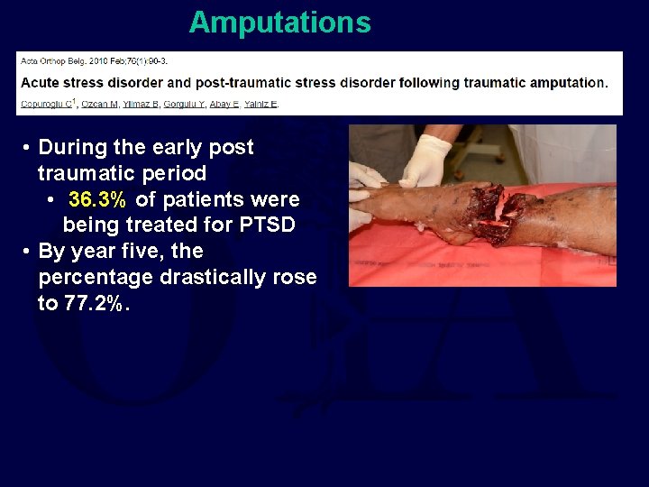 Amputations • During the early post traumatic period • 36. 3% of patients were
