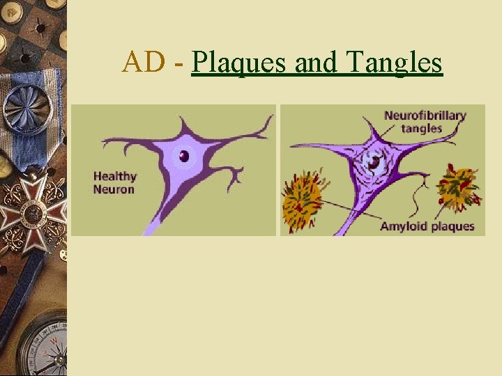 AD - Plaques and Tangles 