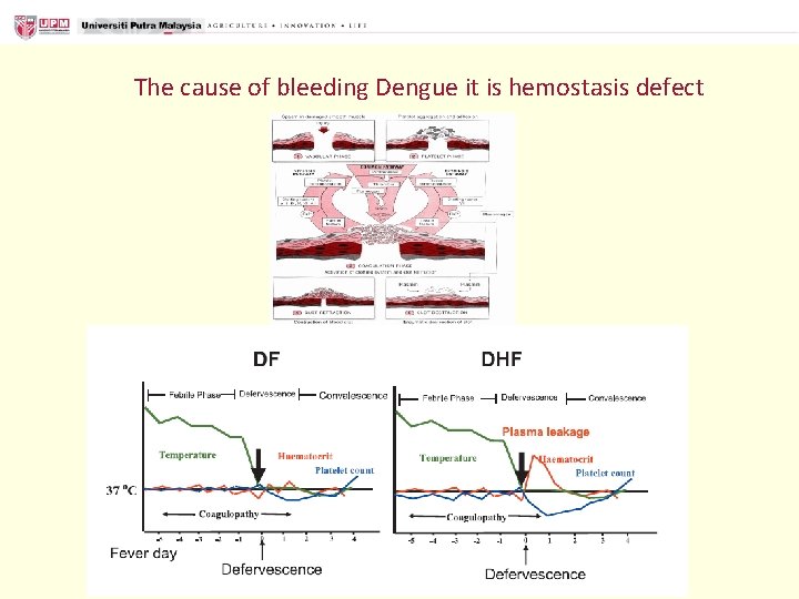 The cause of bleeding Dengue it is hemostasis defect 