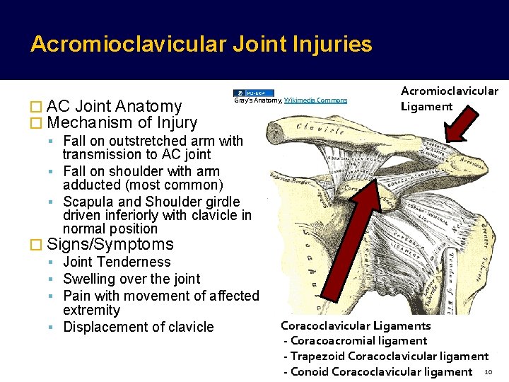 Acromioclavicular Joint Injuries Gray’s Anatomy, Wikimedia Commons � AC Joint Anatomy � Mechanism of Acromioclavicular Joint Injuries Gray’s Anatomy, Wikimedia Commons � AC Joint Anatomy � Mechanism of