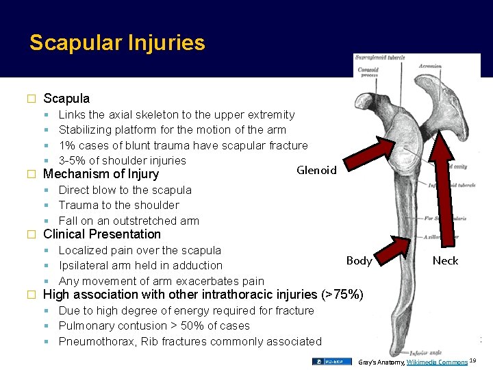 Scapular Injuries � Scapula � Links the axial skeleton to the upper extremity Stabilizing Scapular Injuries � Scapula � Links the axial skeleton to the upper extremity Stabilizing