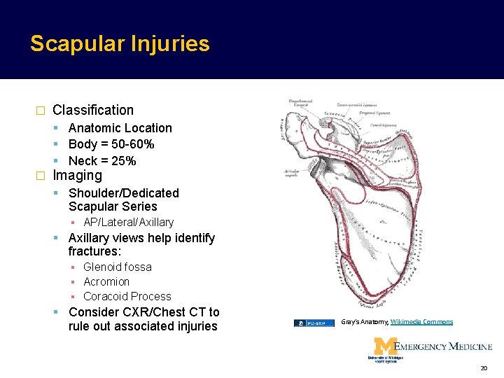 Scapular Injuries � Classification Anatomic Location Body = 50 -60% Neck = 25% � Scapular Injuries � Classification Anatomic Location Body = 50 -60% Neck = 25% �