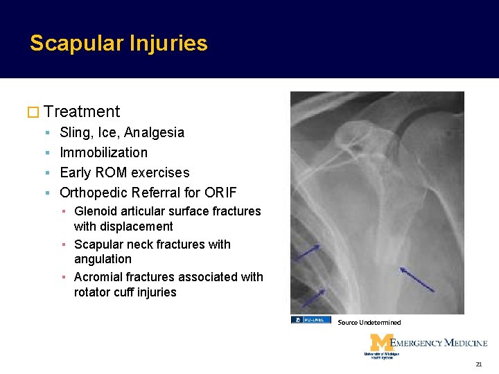 Scapular Injuries � Treatment Sling, Ice, Analgesia Immobilization Early ROM exercises Orthopedic Referral for Scapular Injuries � Treatment Sling, Ice, Analgesia Immobilization Early ROM exercises Orthopedic Referral for